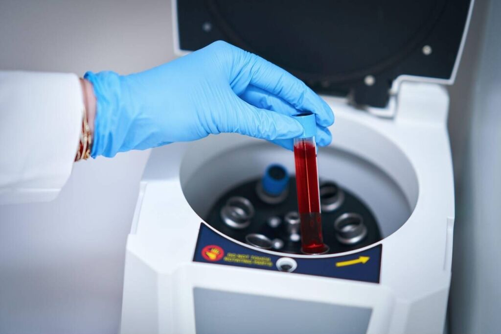 Gloved hand loading blood sample tubes into a lab centrifuge